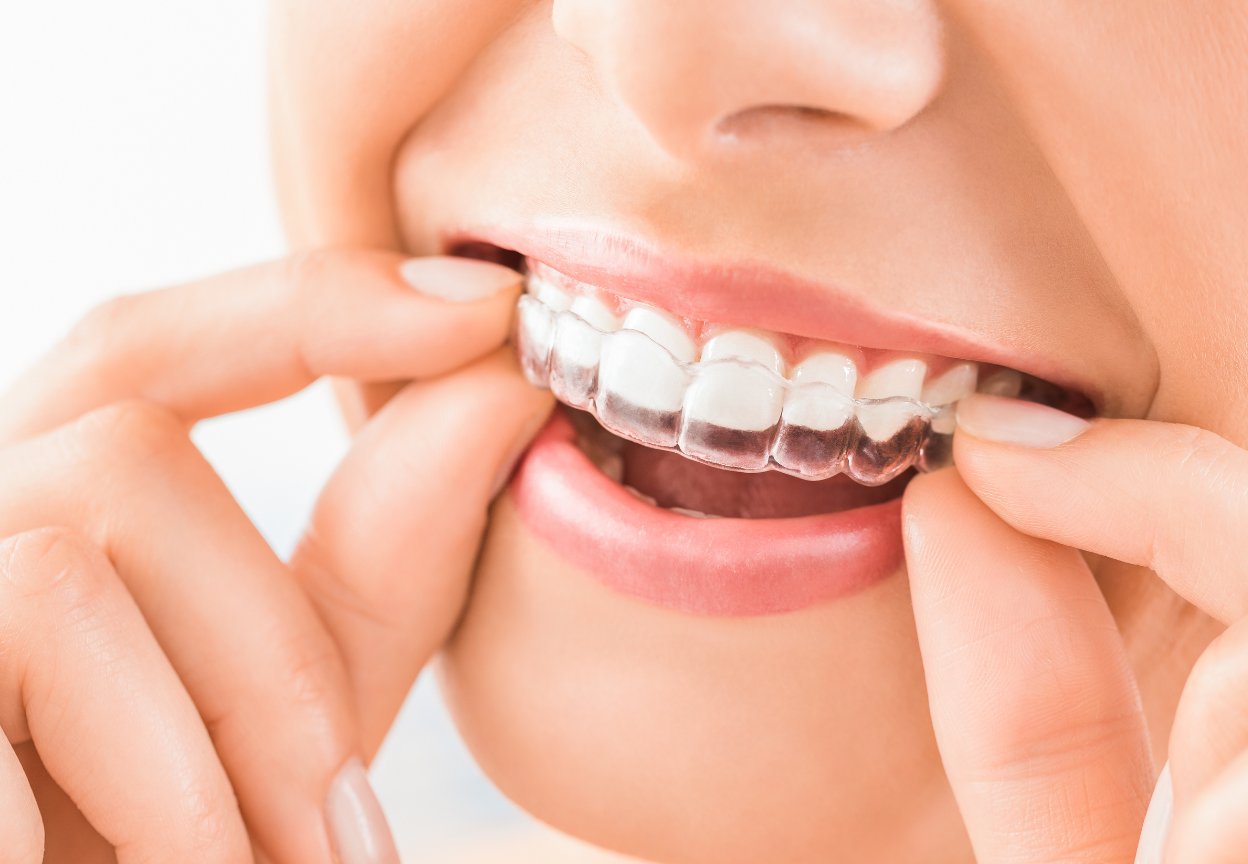 clinica dental erika barjola alcorcon