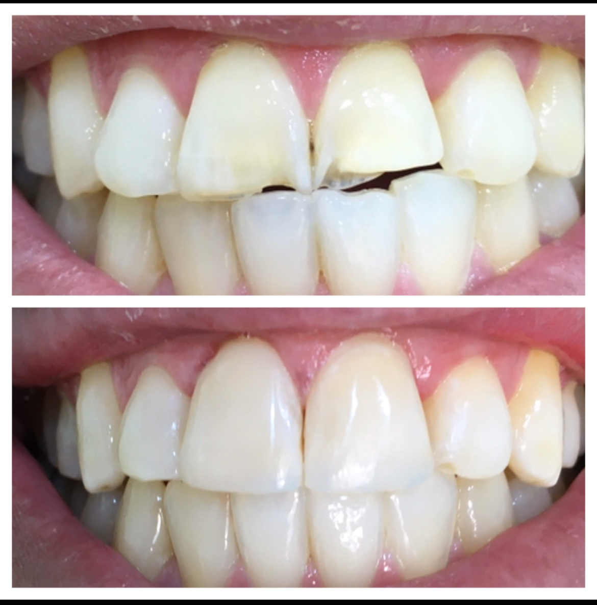 clinica dental erika barjola alcorcon