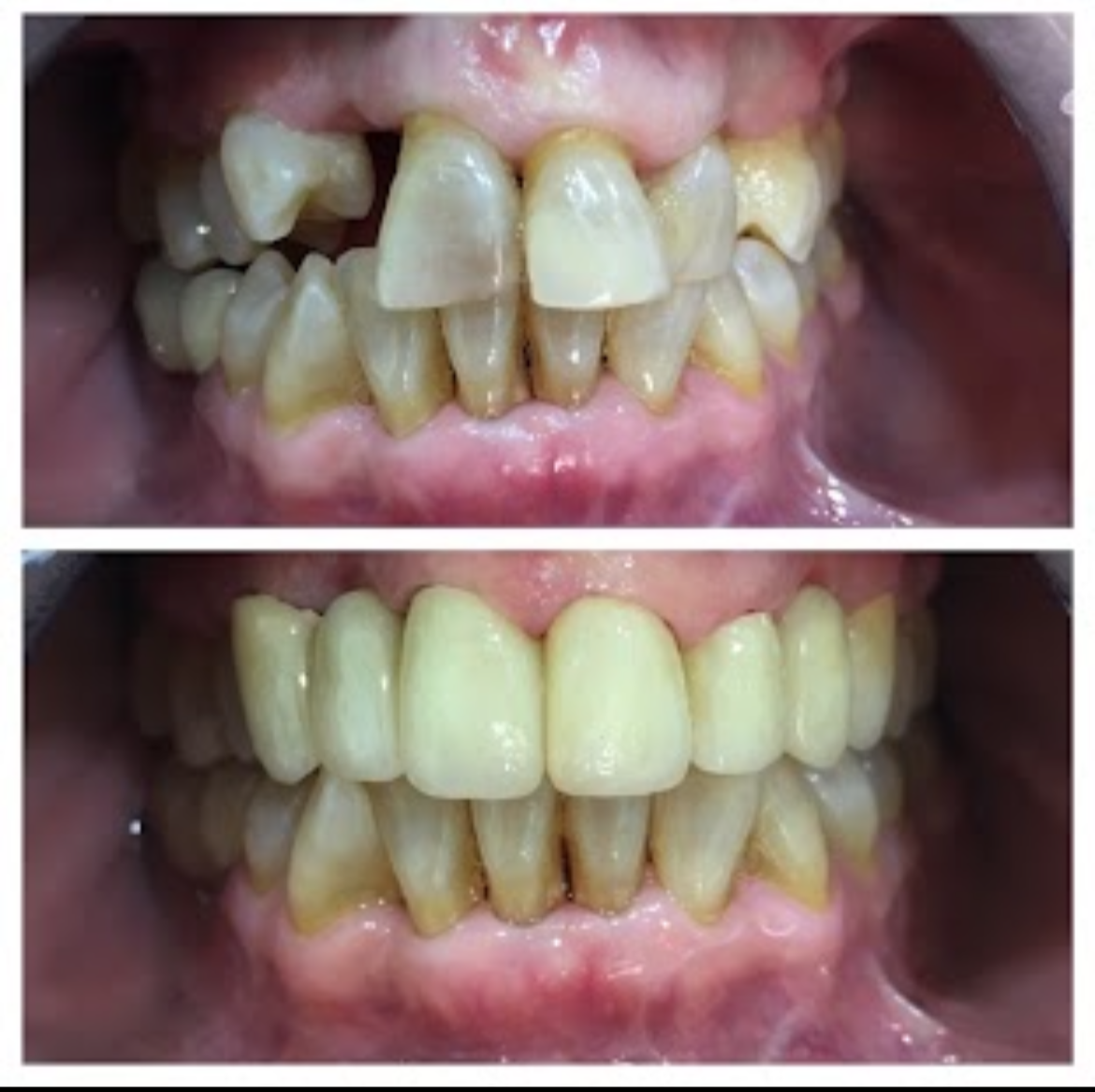 clinica dental erika barjola alcorcon